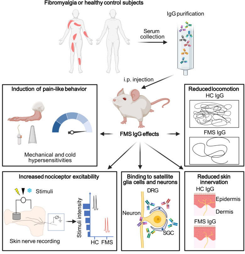 An illustration of passive transfer of fibromyalgia symptoms from patients to mice