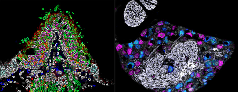 bildcollage, två illustrationer.