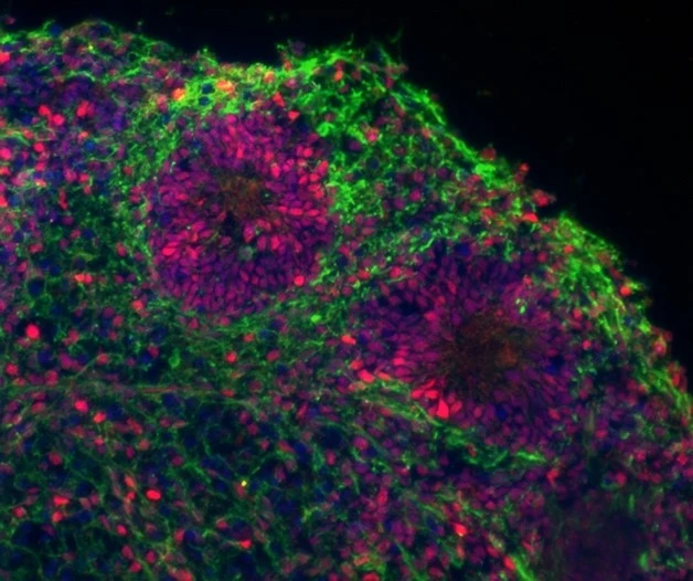 Wilhelm lab, graphic illustration of cerebellar organoid derived from iPS cells
