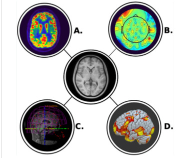 illustration av metoderna