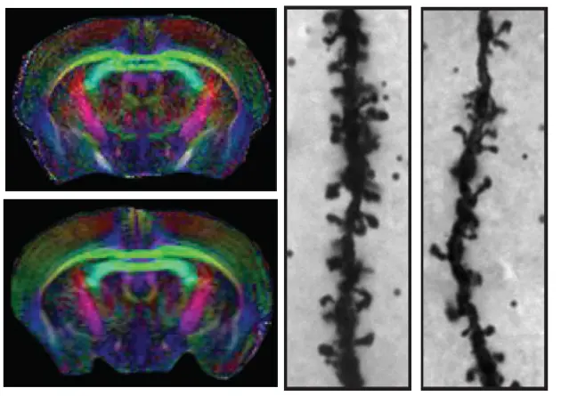 Overexpression of Nogo receptor 1 (NgR1) in forebrain neurons does not affect gross brain anatomy but inhibits the formation of dendritic spines.