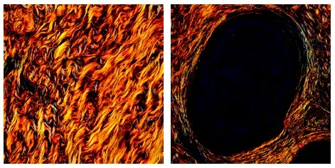 Två bilder med mörk bakgrund och olika mönster i orange, röda och gula nyanser.