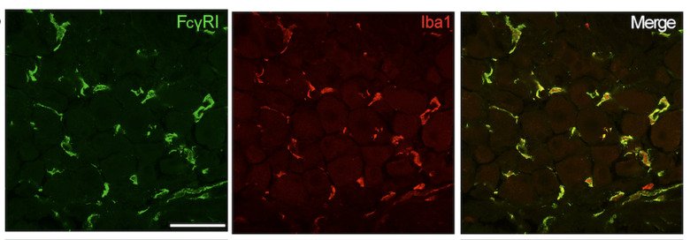 FcgRI (green) is expressed on macrophages (Iba1, red) in DRG tissue