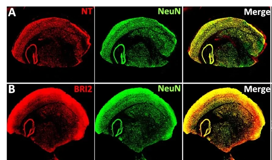 Research pictures of mouse brains in different colours.