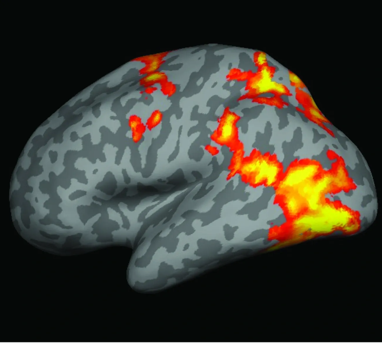 Image of the brain in various colours against a black background