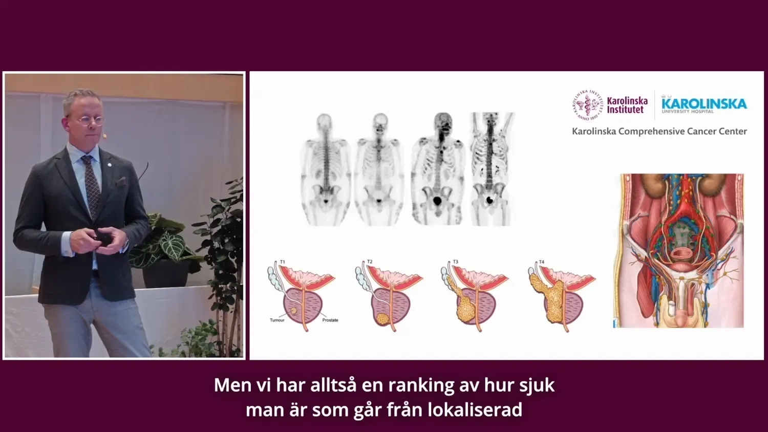 Kan man skräddarsy behandlingar för prostatacancer