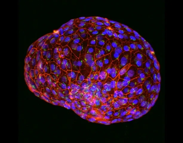 Human embryo
