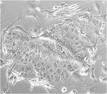 Microscope picture of a LT-hPGCLC coculture