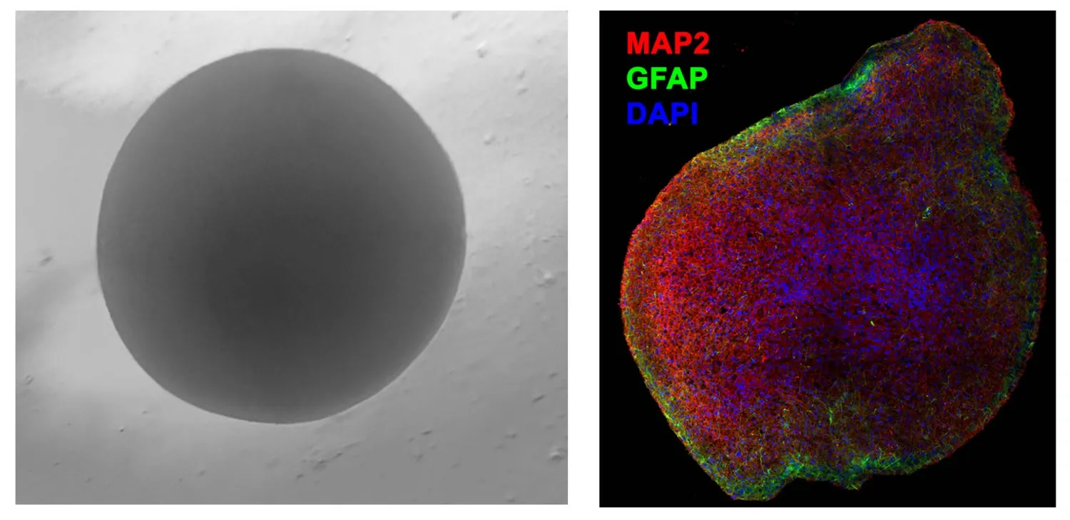 Organoid