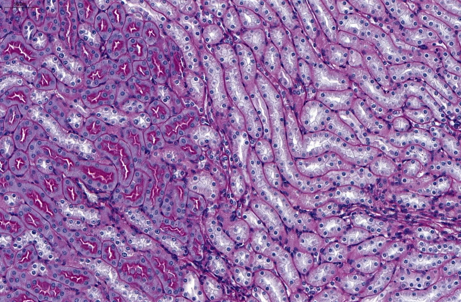 Image of PAS staining for basement membranes, Kidney