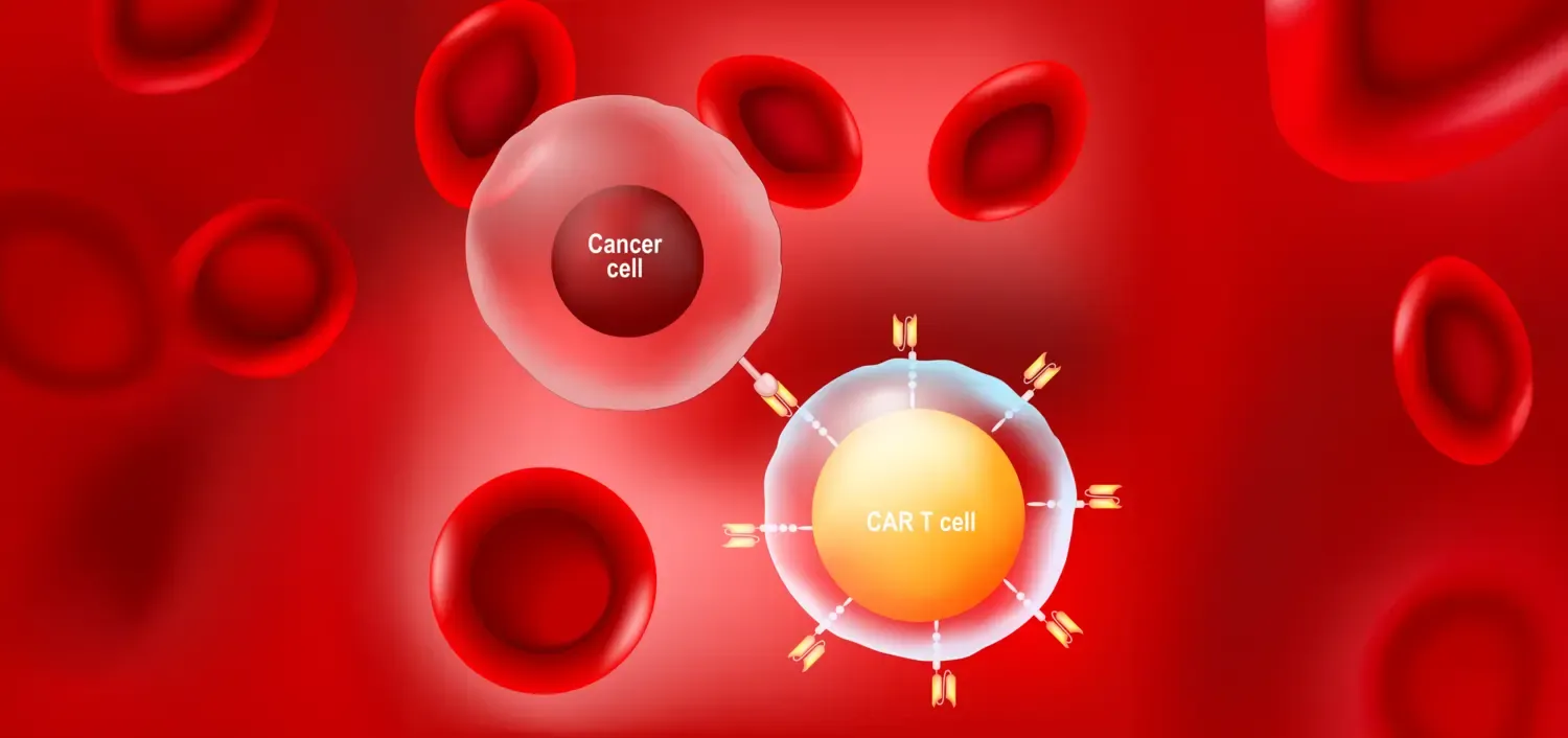 CAR T cell therapy involves genetically modifying the patient's own T-cells to be able to attack cancer cells. The illustration shows a cancer cell and a modified T cell.