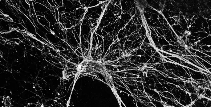 Neurons