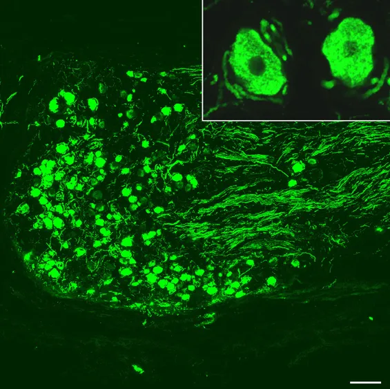 Immunofluorescence micrograph of human dorsal root ganglion after incubation with antiserum to the neuropeptide calcitonin gene-related peptide (CGRP).