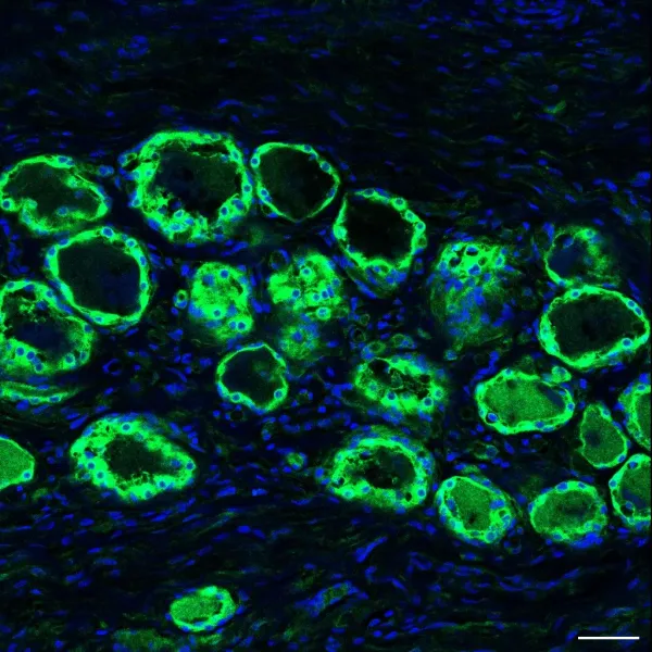 Immunohistochemistry (IHC) in human dorsal root ganglia; 20x magnification.