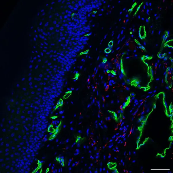 IHC in mouse skin (epidermis & dermis), 20x magnification.