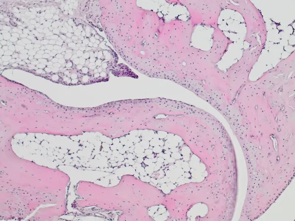 Colour image showing an enlargement of a mouse bone.