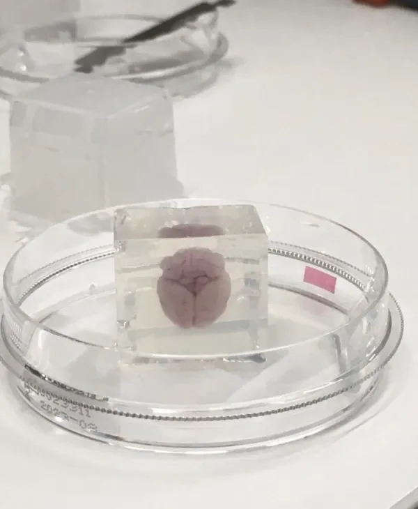 Mouse brain prepared for vibratome sectioning.