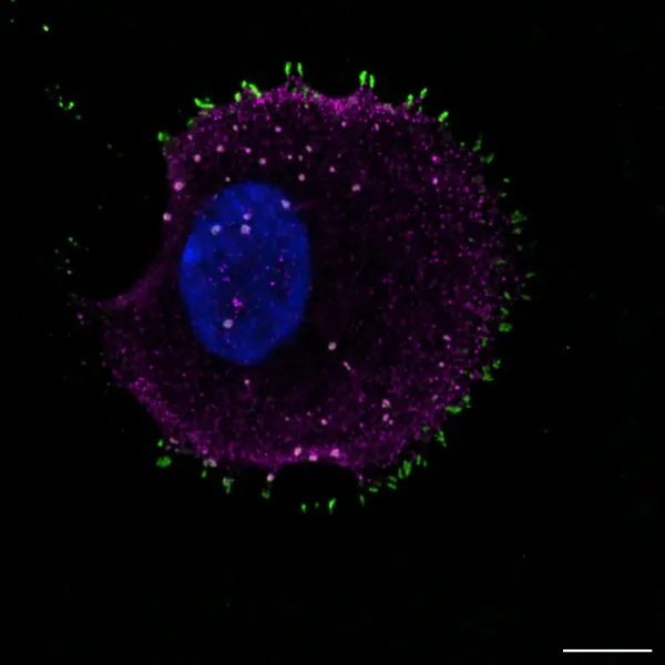 Reticular adhesions and focal adhesions