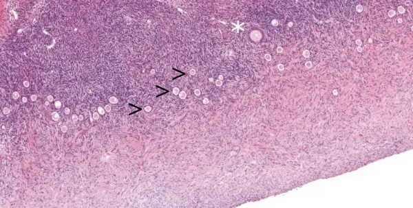 Primordialfolliklar. Foto: Magdalena Wagner.