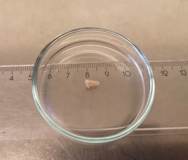 Provbit från äggstocken. Foto: Richelle Duque Björvang.