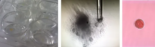 Studier på äggstocksfolliklar i odling. Foto: Pauliina Damdimopoulou, Marjut Otala, Astrud Tuck.