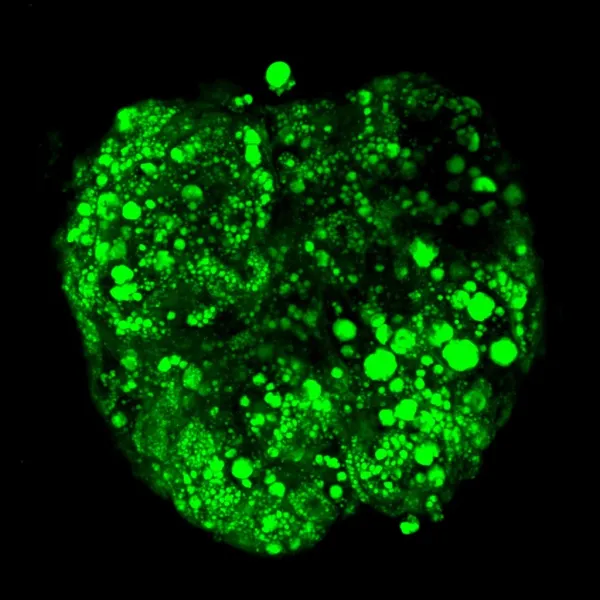 primary human hepatocytes and stellate cells spheroid