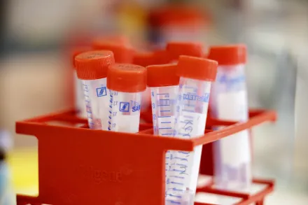 Detail image from lab