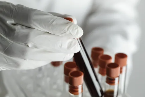 Test tubes containing blood samples.