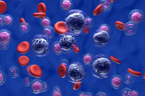 Illustration of acute myeloid leukemia (AML) cells in blood flow